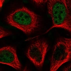 Immunofluorescent staining of human cell line U-2 OS shows localization to nucleoplasm.