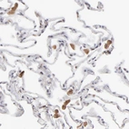 Immunohistochemical staining of human lung shows strong cytoplasmic positivity in macrophages.