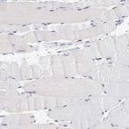 Immunohistochemical staining of human skeletal muscle shows no positivity in myocytes as expected.