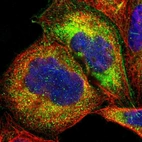 Immunofluorescent staining of human cell line A-431 shows localization to cytosol.