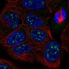 Anti-CXorf57 Antibody