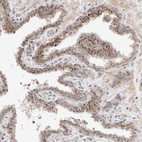 Immunohistochemical staining of human prostate shows strong cytoplasmic granular positivity in glandular cells.
