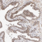 Immunohistochemical staining of human prostate shows strong cytoplasmic granular positivity in glandular cells.