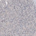Immunohistochemical staining of human pancreas shows no cytoplasmic positivity in exocrine glandular cells as expected.