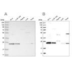 Western blot analysis using Anti-VPS28 antibody HPA024745 (A) shows similar pattern to independent antibody HPA024688 (B).