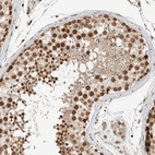 Immunohistochemical staining of human testis shows strong nuclear positivity in cells in seminiferous ducts.