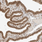 Immunohistochemical staining of human fallopian tube shows strong nuclear positivity in glandular cells.