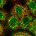 Immunofluorescent staining of human cell line A-431 shows localization to nucleoplasm & cytosol.