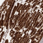 Immunohistochemical staining of human heart muscle shows strong cytoplasmic positivity in cardiomyocytes.