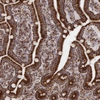 Immunohistochemical staining of human duodenum shows strong cytoplasmic positivity in glandular cells.