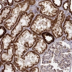 Immunohistochemical staining of human kidney shows strong cytoplasmic positivity in cells in tubules.