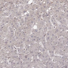 Immunohistochemical staining of human liver shows no positivity in hepatocytes as expected.