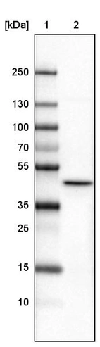 Lane 1: Marker [kDa]_br/_Lane 2:Human cell line U-251 MG