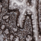 Immunohistochemical staining of human small intestine shows strong nuclear positivity in glandular epithelium and in lamina propria cells.