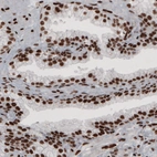 Immunohistochemical staining of human prostate shows strong nuclear positivity in glandular and connective tissue cells.