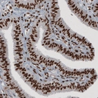 Immunohistochemical staining of human fallopian tube shows strong nuclear immunoreactivity.