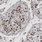 Immunohistochemical staining of human testis shows nuclear positivity in seminiferous tubules.
