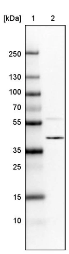 Lane 1: Marker [kDa]_br/_Lane 2:Human cell line U-251 MG