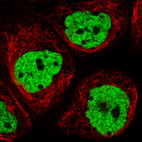 Immunofluorescence staining in A431 cell line with Anti-HNRNPC monoclonal antibody, showing distinct nuclear (without nucleoli) staining in green. Microtubule- and nuclear probes are visualized in red and blue respectively (where available).