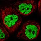 Immunofluorescence staining in A431 cell line with Anti-HNRNPC monoclonal antibody, showing distinct nuclear (without nucleoli) staining in green. Microtubule- and nuclear probes are visualized in red and blue respectively (where available).