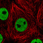Immunofluorescence staining in MCF7 cell line with Anti-HNRNPC monoclonal antibody, showing distinct nuclear (without nucleoli) staining in green. Microtubule- and nuclear probes are visualized in red and blue respectively (where available).