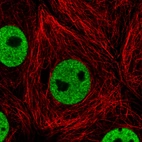 Immunofluorescence staining in MCF7 cell line with Anti-HNRNPC monoclonal antibody, showing distinct nuclear (without nucleoli) staining in green. Microtubule- and nuclear probes are visualized in red and blue respectively (where available).