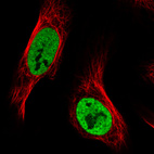 Anti-HNRNPC Antibody