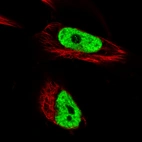 Immunofluorescence staining in U251 cell line with Anti-HNRNPC monoclonal antibody, showing distinct nuclear (without nucleoli) staining in green. Microtubule- and nuclear probes are visualized in red and blue respectively (where available).