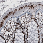 Immunohistochemical staining of human rectum shows strong nuclear positivity in glandular and lamina propria cells.