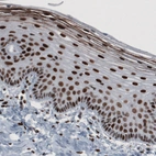 Immunohistochemical staining of human cervix shows strong nuclear immunoreactivity.