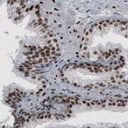 Immunohistochemical staining of human prostate shows strong nuclear positivity in glandular and connective tissue cells.