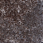 Immunohistochemical staining of human lymph node shows strong nuclear immunoreactivity in lymphocytes.