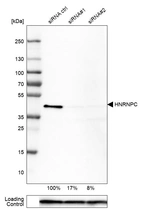 Western blot analysis in U-251MG cells transfected with control siRNA, target specific siRNA probe #1 and #2, using Anti-HNRNPC antibody. Remaining relative intensity is presented. Loading control: Anti-PPIB.