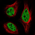 Immunofluorescence staining in HeLa cell line with Anti-HNRNPC monoclonal antibody, showing distinct nuclear (without nucleoli) staining in green. Microtubule- and nuclear probes are visualized in red and blue respectively (where available).