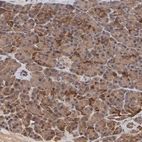Immunohistochemical staining of human pancreas shows strong cytoplasmic and membranous positivity in exocrine glandular cells.