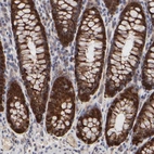 Immunohistochemical staining of human rectum shows strong cytoplasmic positivity in glandular cells.