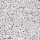 Immunohistochemical staining of human liver shows no cytoplasmic positivity in hepatocytes as expected.