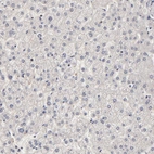 Immunohistochemical staining of human liver shows no cytoplasmic positivity in hepatocytes as expected.