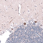 Immunohistochemical staining of human cerebellum shows strong nuclear and cytoplasmic positivity in Purkinje cells.