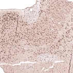 Immunohistochemical staining of mouse thalamus shows strong nuclear positivity in neurons.