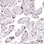 Immunohistochemical staining of human placenta shows no nuclear positivity in trophoblastic cells as expected.