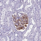 Immunohistochemical staining of human kidney shows strong membranous positivity in cells in glomeruli.