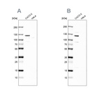 Western blot analysis using Anti-MAP6 antibody HPA039061 (A) shows similar pattern to independent antibody HPA039062 (B).