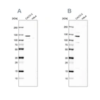 Western blot analysis using Anti-MAP6 antibody HPA039061 (A) shows similar pattern to independent antibody HPA039062 (B).