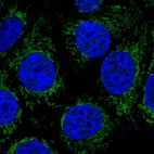Anti-ABHD11 Antibody