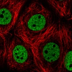 Immunofluorescence staining in MCF7 cell line with Anti-HNRNPC monoclonal antibody, showing distinct nuclear (without nucleoli) staining in green. Microtubule- and nuclear probes are visualized in red and blue respectively (where available).