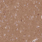 Immunohistochemical staining of human cerebral cortex shows strong cytoplasmic positivity in neuropil.