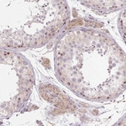 Immunohistochemical staining of human testis shows moderate cytoplasmic granular positivity in Leydig cells.