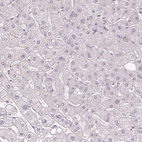 Immunohistochemical staining of human liver shows no cytoplasmic positivity in hepatocytes as expected.