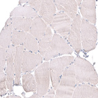 Immunohistochemical staining of human skeletal muscle shows negative to very weak cytoplasmic positivity in myocytes.